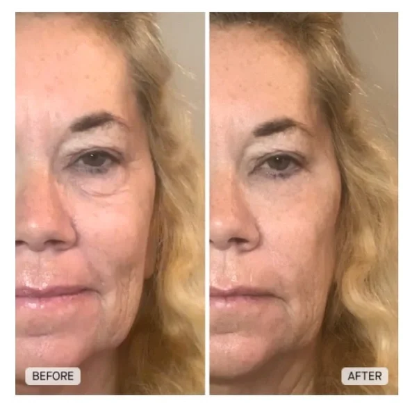 IL MAKIAGE Power Rewind Eye Treatment (Sealed) - Picture 6 of 7